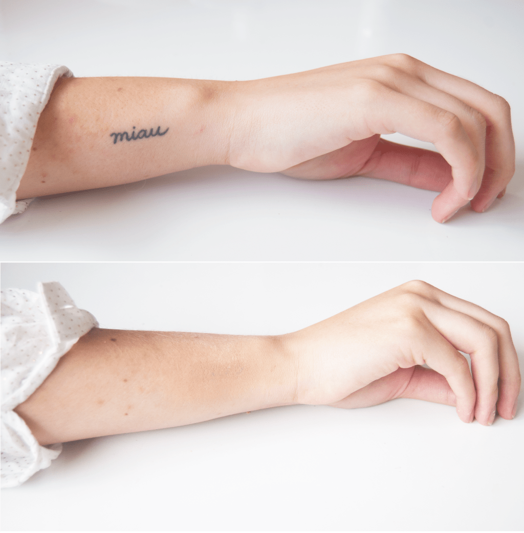 S.O.S.: Cómo cubrir&nbsp;tatuajes